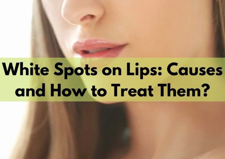 White Spots on Lips