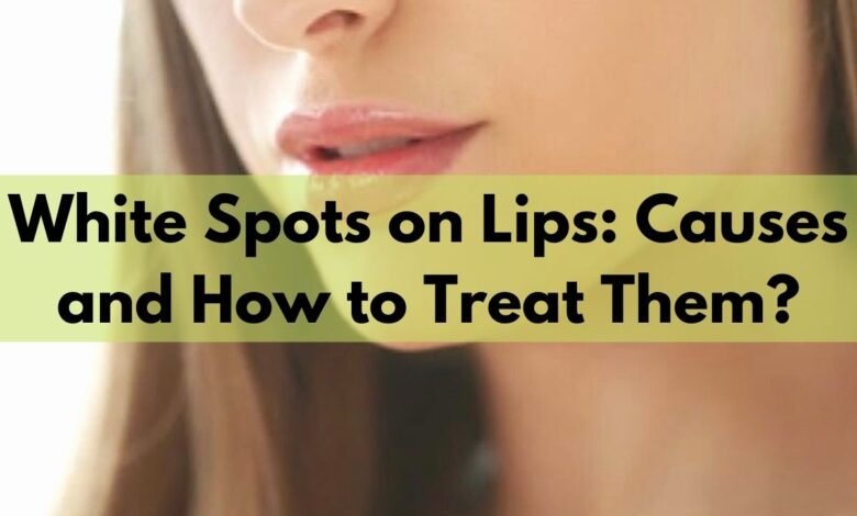 White Spots on Lips