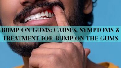 Bump on Gums