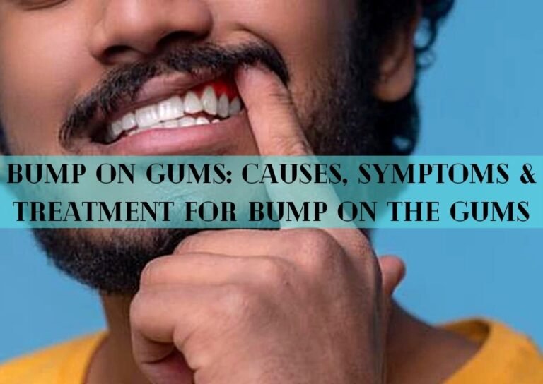Bump on Gums