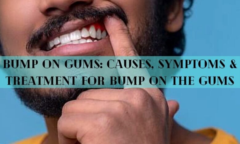 Bump on Gums