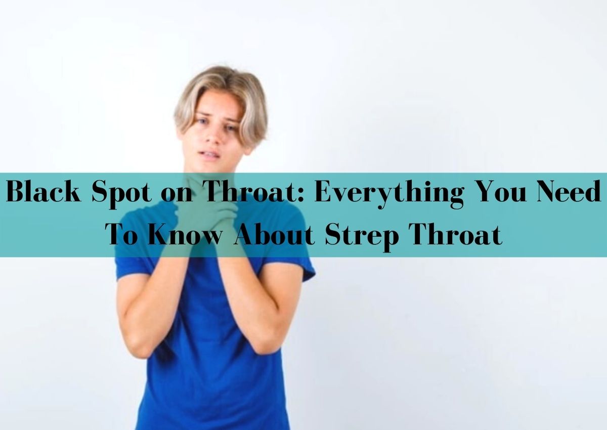 Black Spot on Throat: Everything You Need To Know!