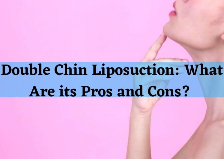 chin liposuction