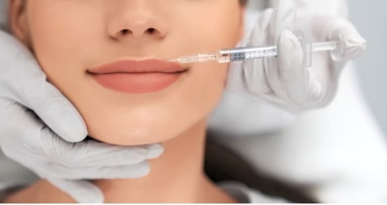 Dermal Fillers