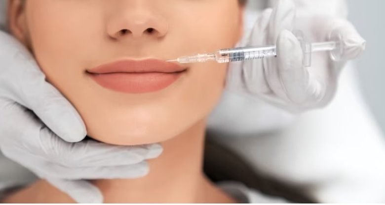 Dermal Fillers