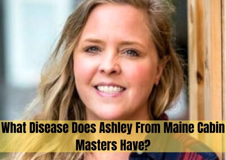 what disease does ashley from maine cabin masters have?