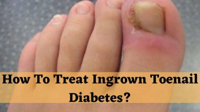 How To Treat Ingrown Toenail Diabetes?