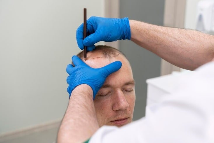 Hair Restoration
