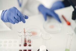 Ebola